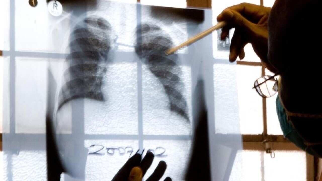 A doctor examines chest X-rays