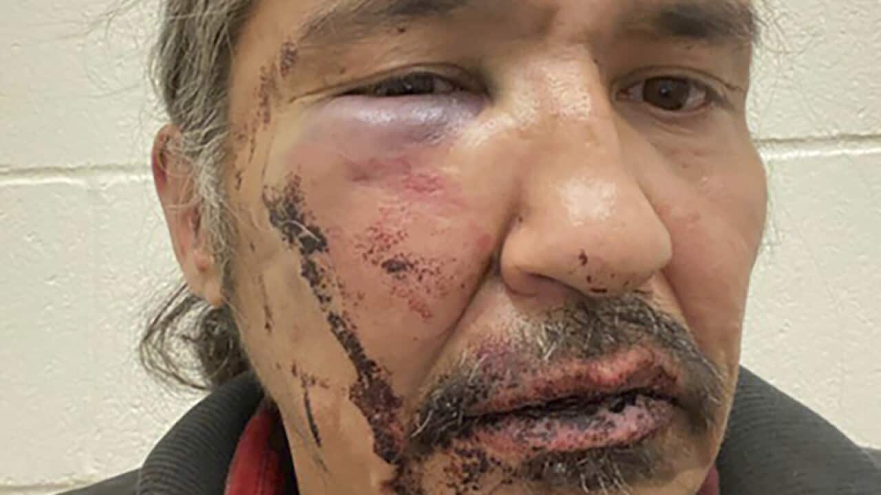 Athabasca Chipewayan Chief Allan Adam.