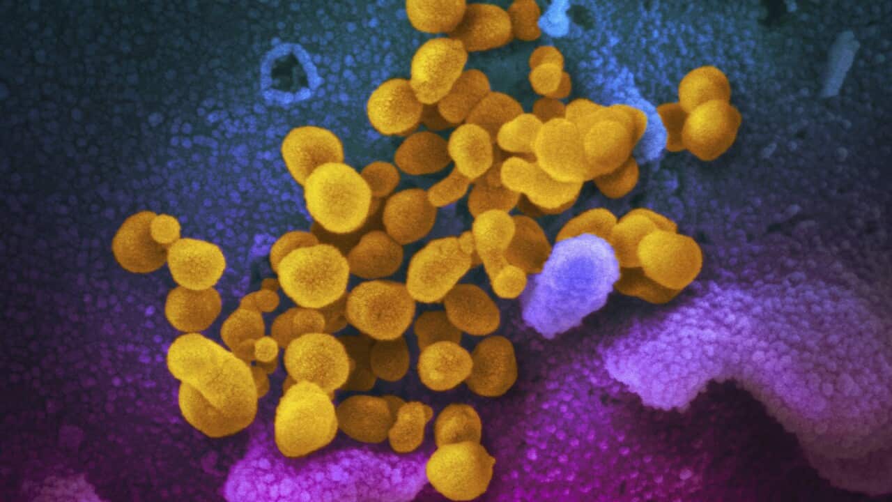The Novel Coronavirus SARS-CoV-2, yellow, emerging from the surface of cells, blue and pink, cultured in the lab