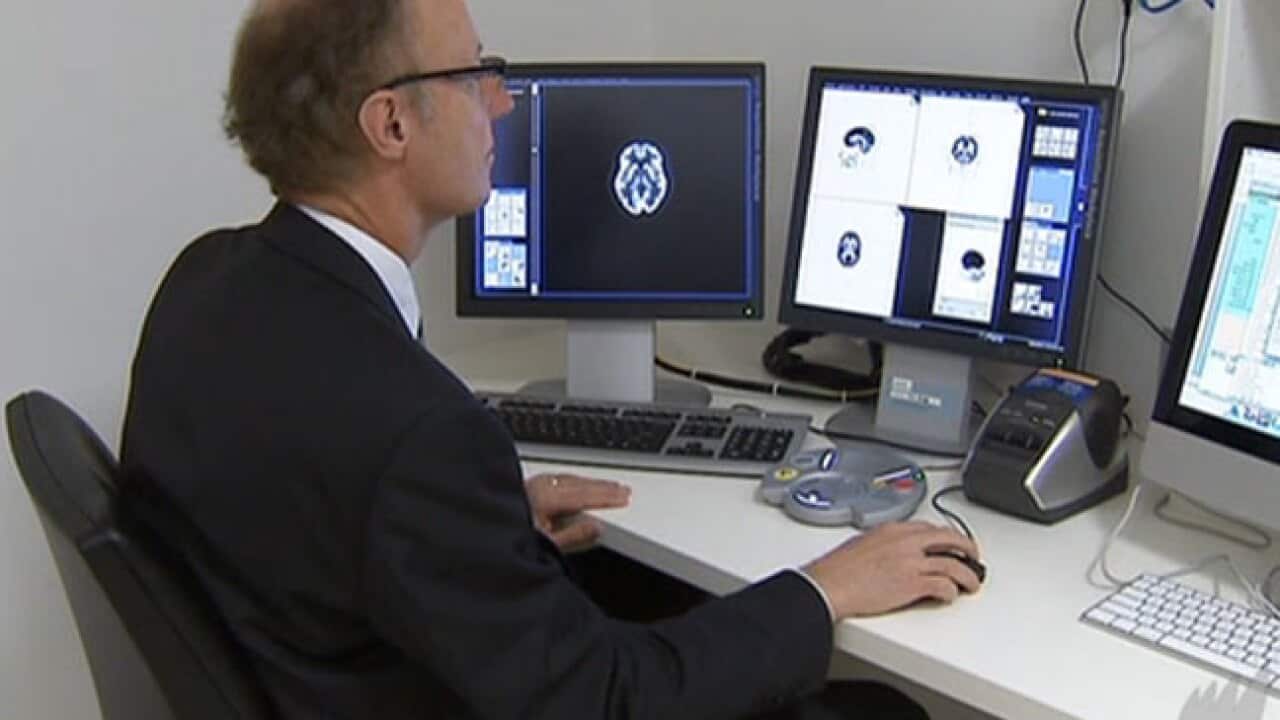 alzheimers_743783717