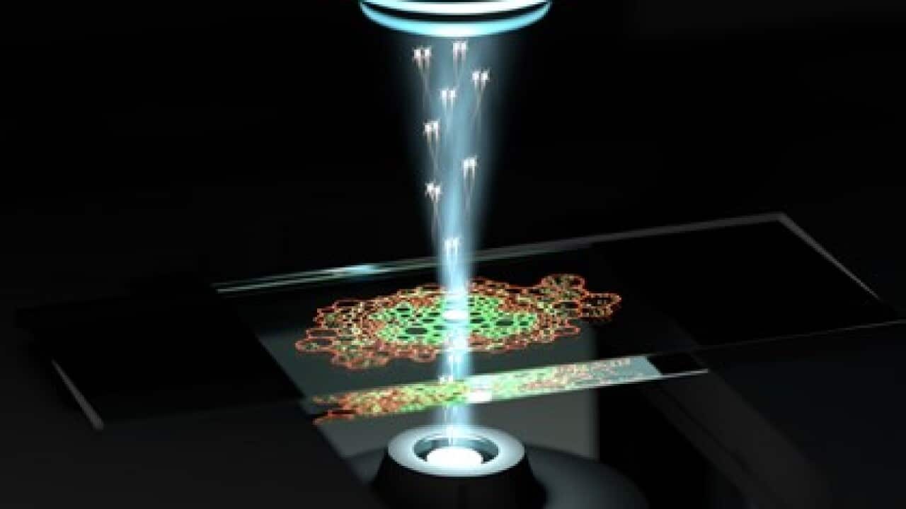 Image for read more article ''