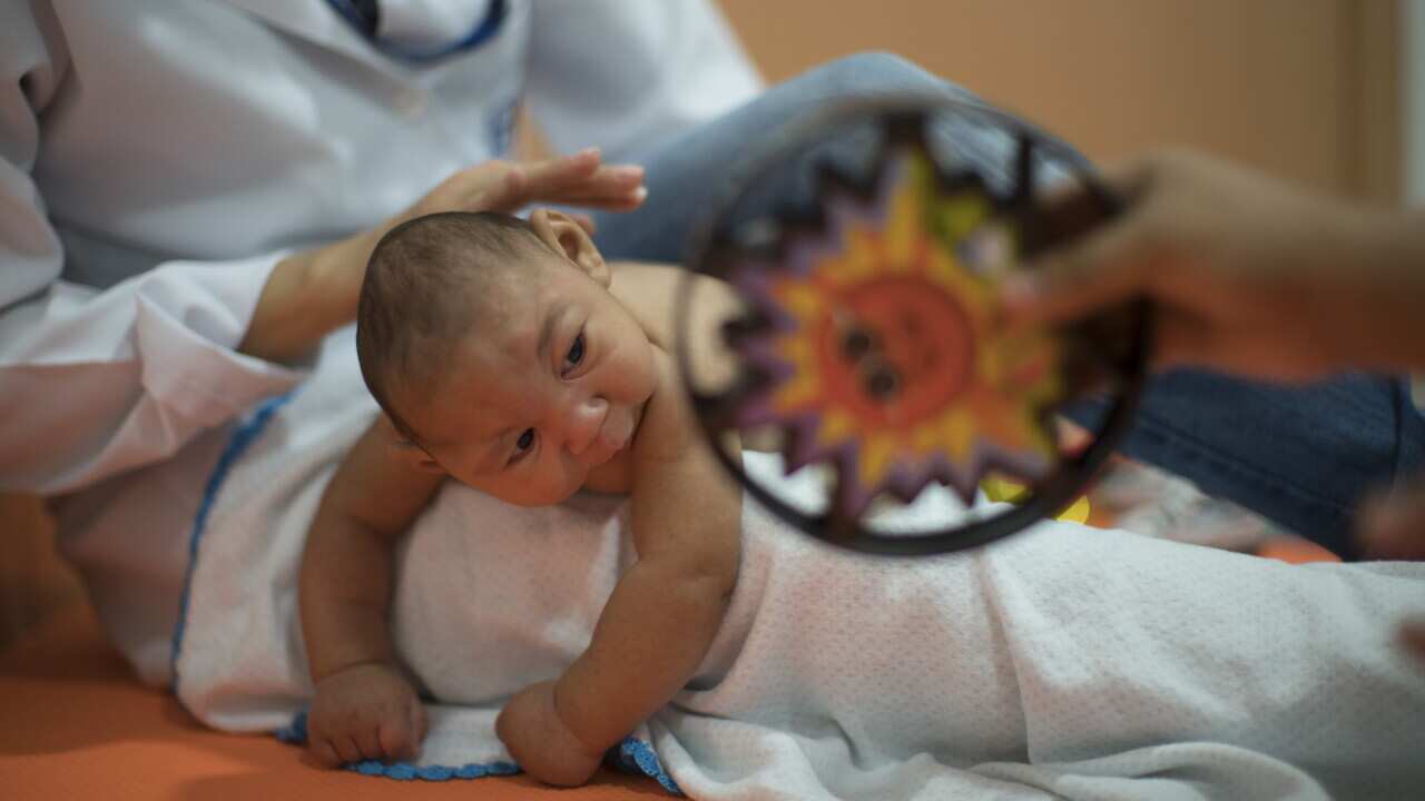 Three-month-old Daniel, who was born with microcephaly, undergoes physical therapy at the Altino Ventura foundation in Recife, Brazil.