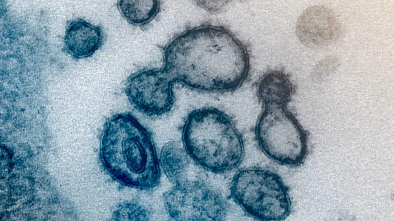 Electron microscope image from the US National Institutes of Health showing the Novel Coronavirus SARS-CoV-2, which causes COVID-19