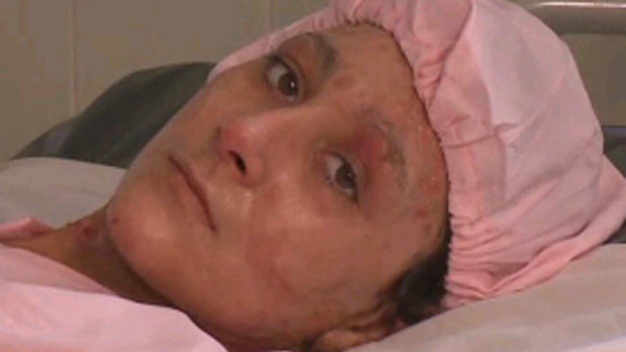 self_immolation_victim_120207_cnn_377256849