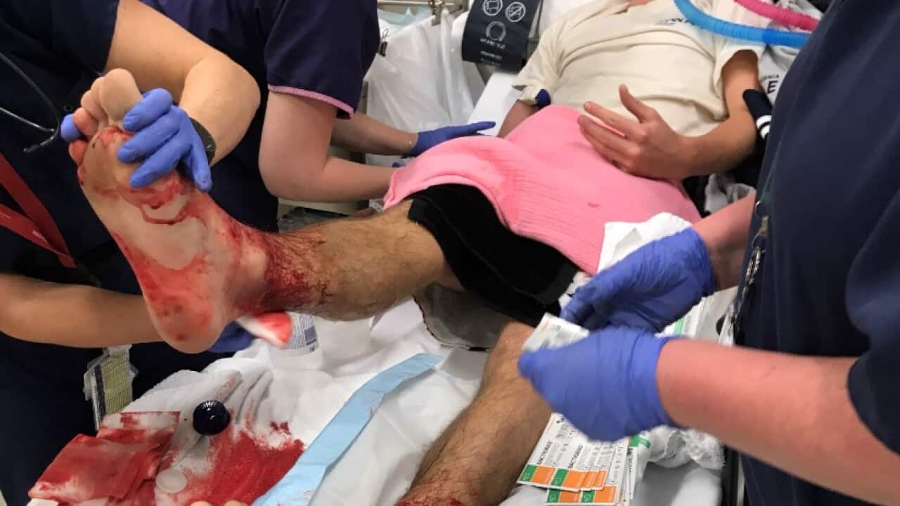 A supplied image obtained on August 6, 2017 of 16-year-old Sam Kanizay in a Melbourne Hospital after sustaining suspected bites from 'tiny marine creatures'