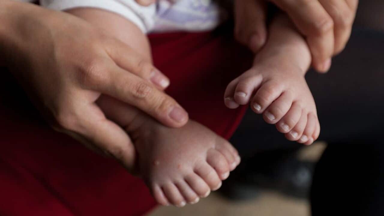 baby, 31 fingers, china