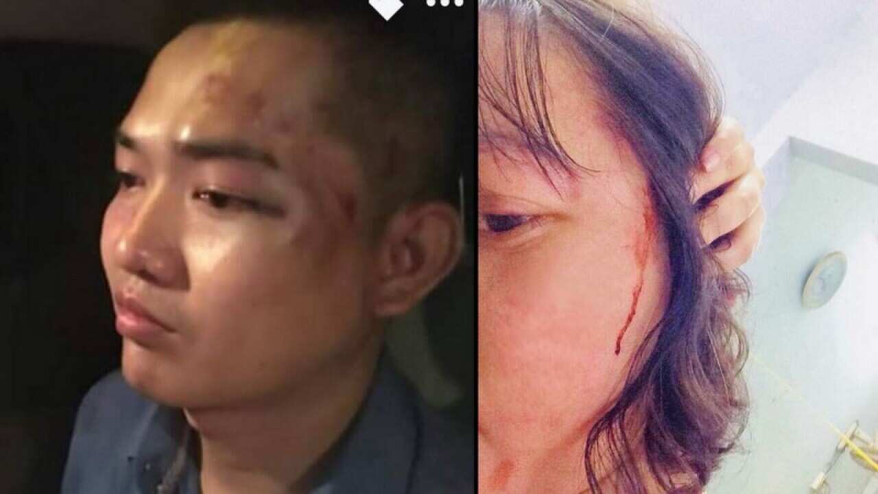 Nguyễn Tín và Phạm Đoan Trang bị đánh vào tối ca nhạc 15/8