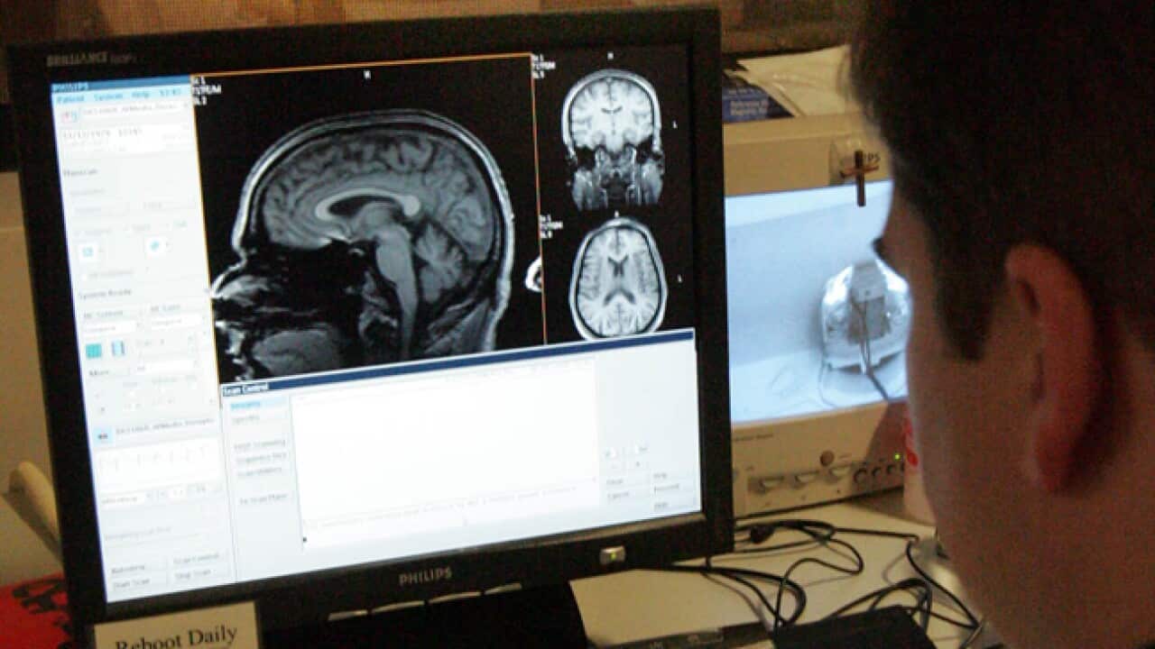 Brain-scan_file_200411_B_AAP_675594443