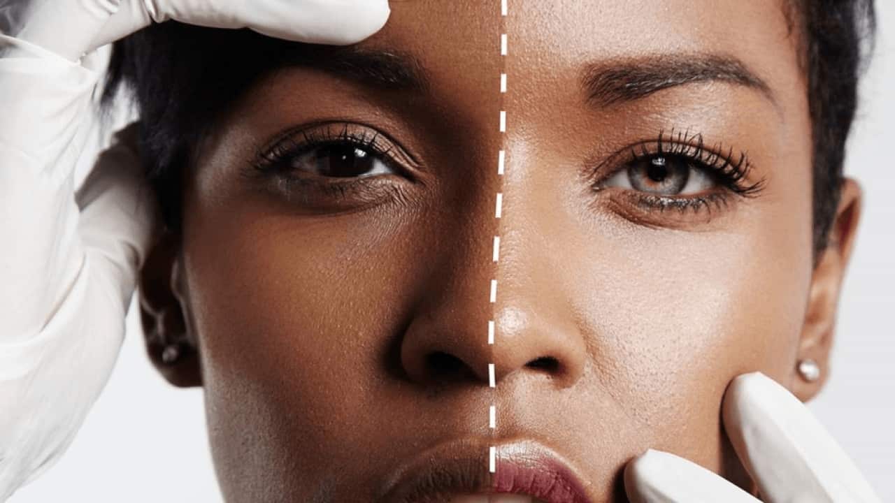 In many parts of Africa skin lightening is a popular practise despite the health risks associated with it.