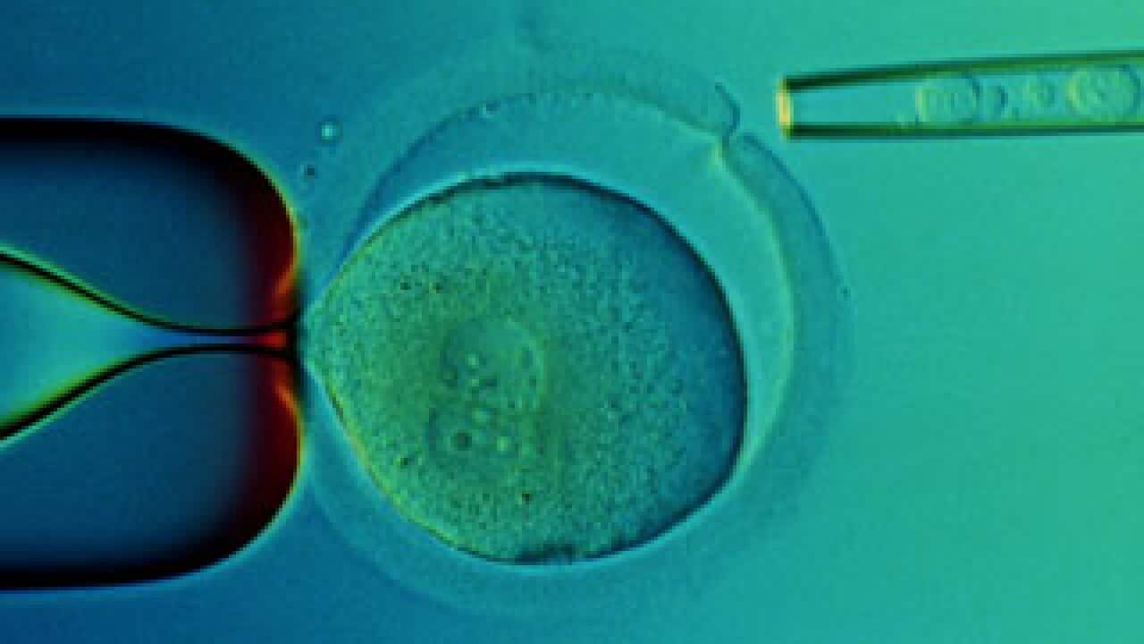 stem cells (getty)
