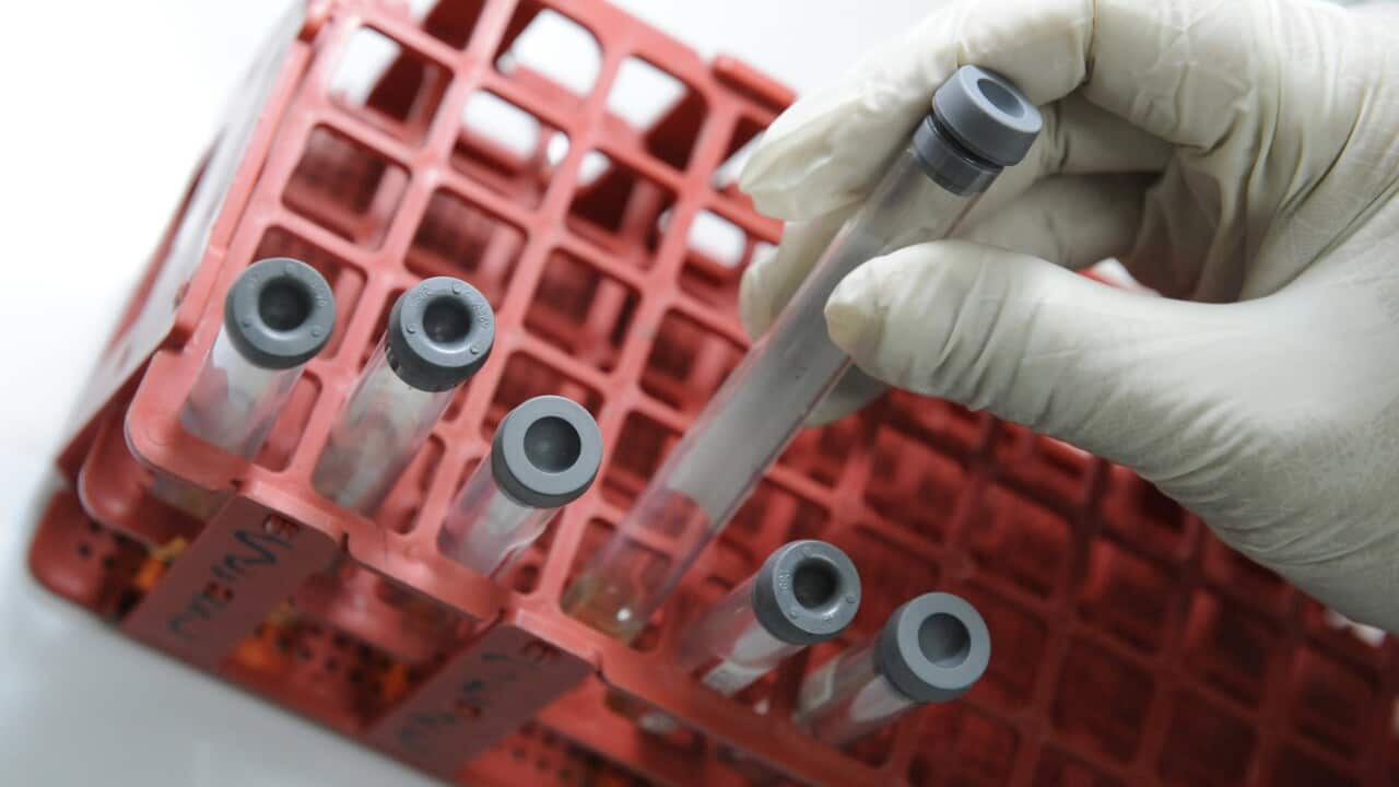 HIV diagnoses are at a 20 year high in Australia a new report has revealed. (AAP)