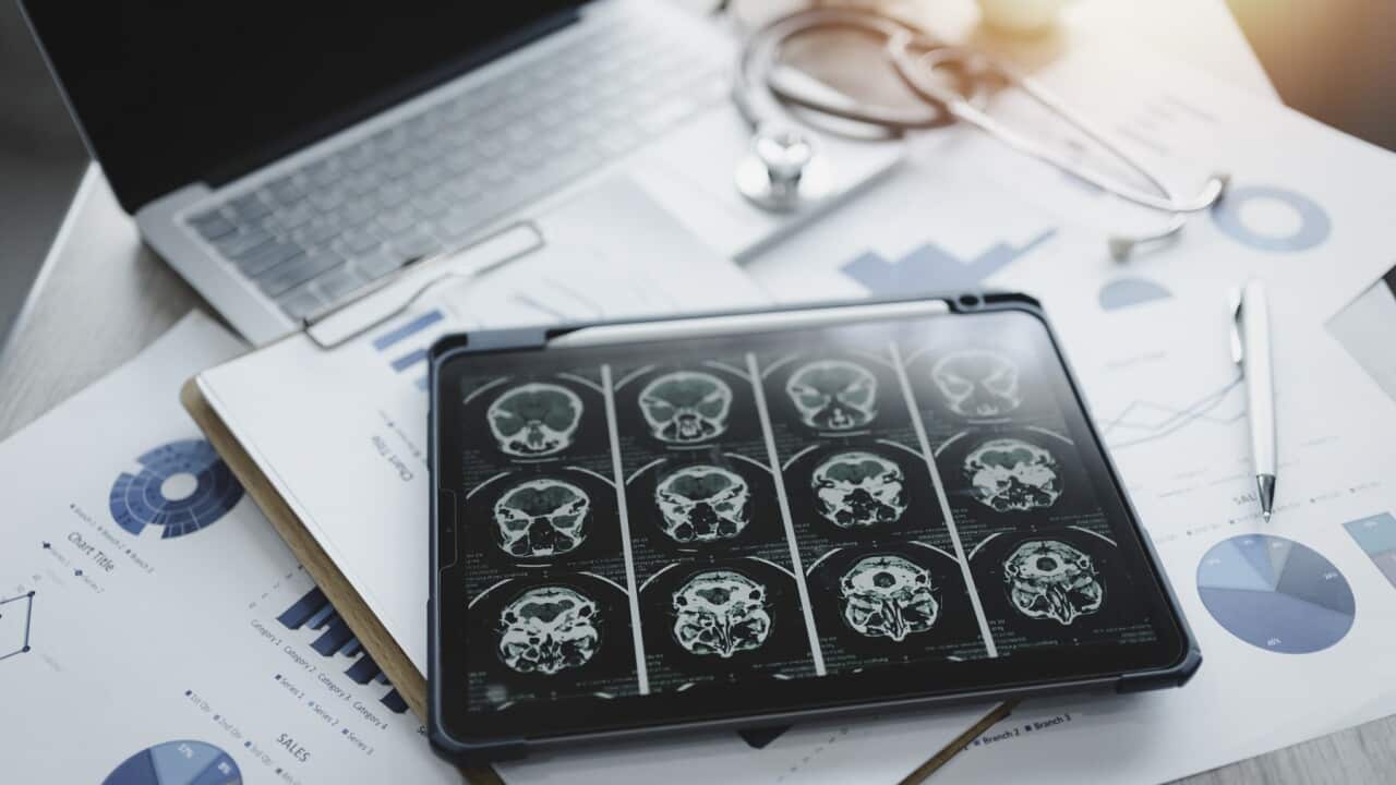 Close-up of a digital tablet with brain x-ray on screen.