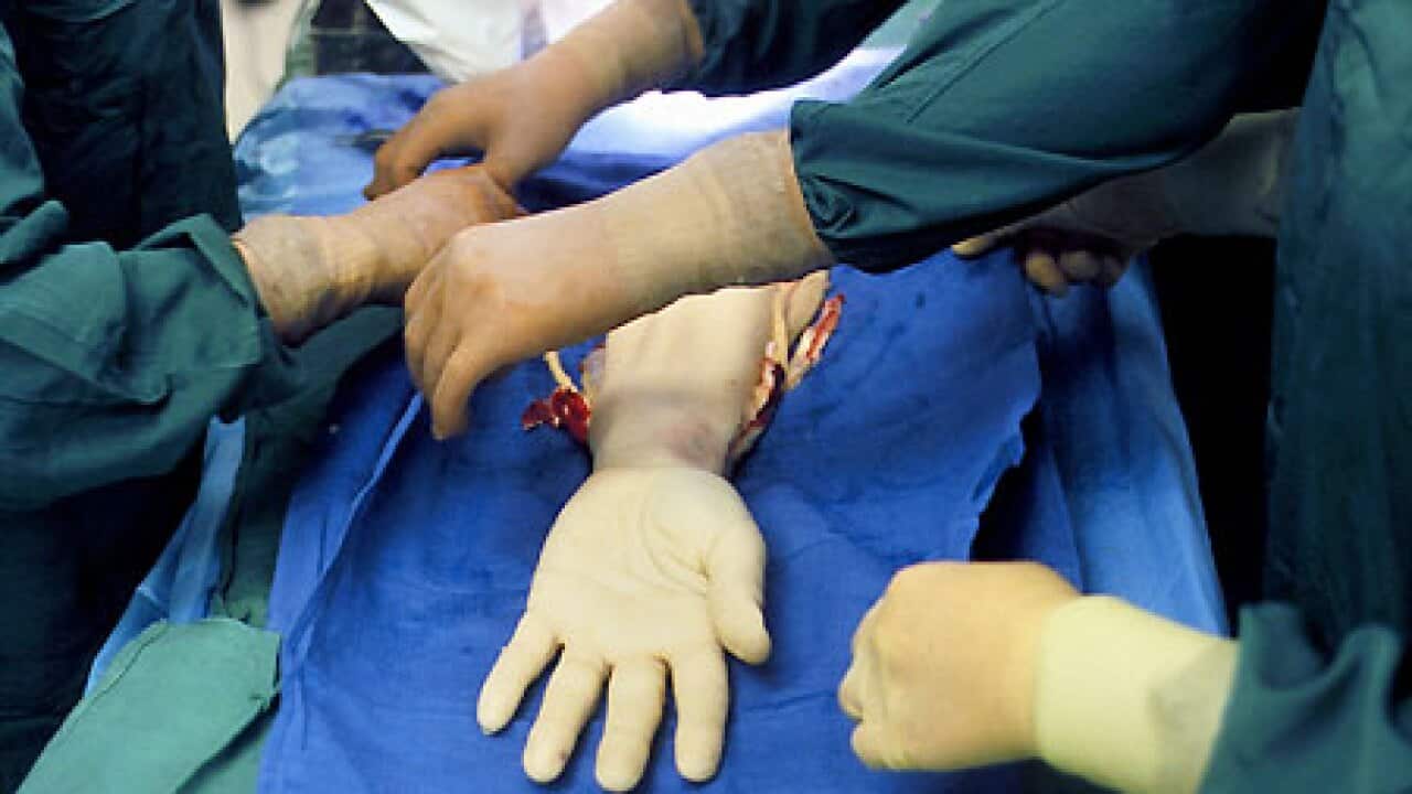 hand_transplant_100303_getty_B_728332937