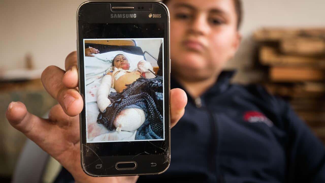 Thaer shows a picture of himself as he lays in a hospital bed with horrific injuries sustained in airstrikes.