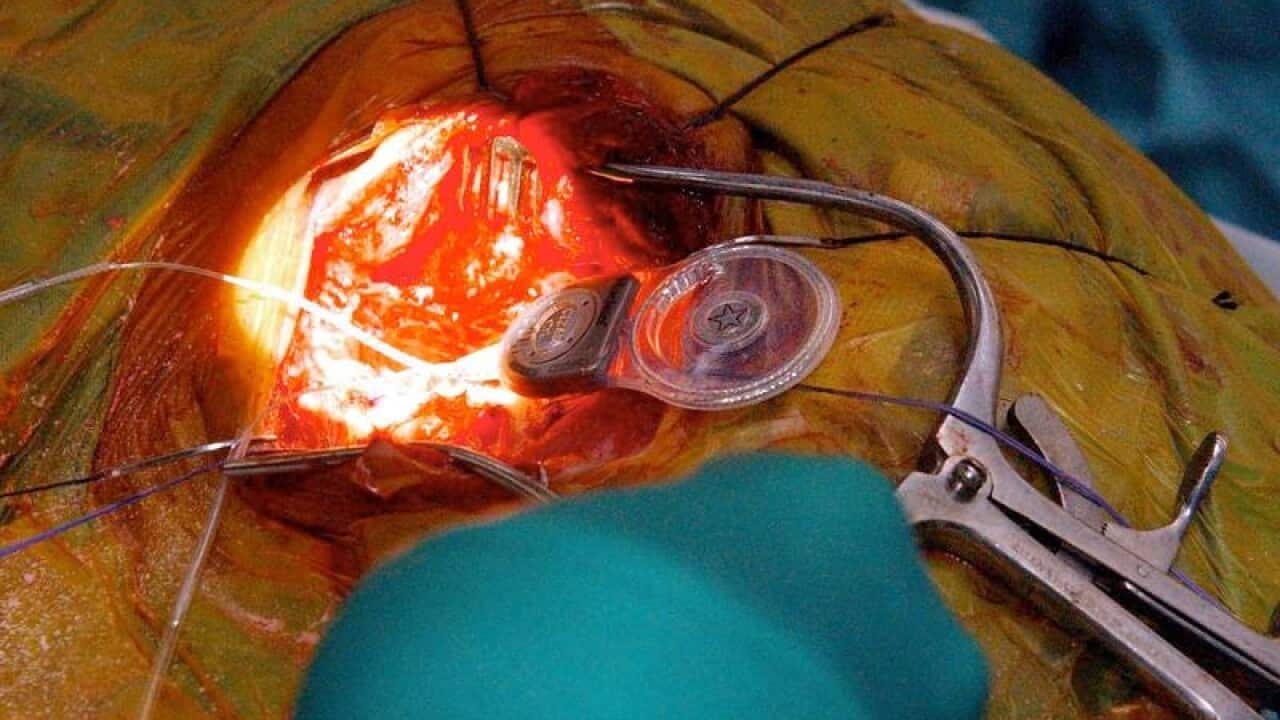 Surgeon operating millimetres from the brain to insert an implant