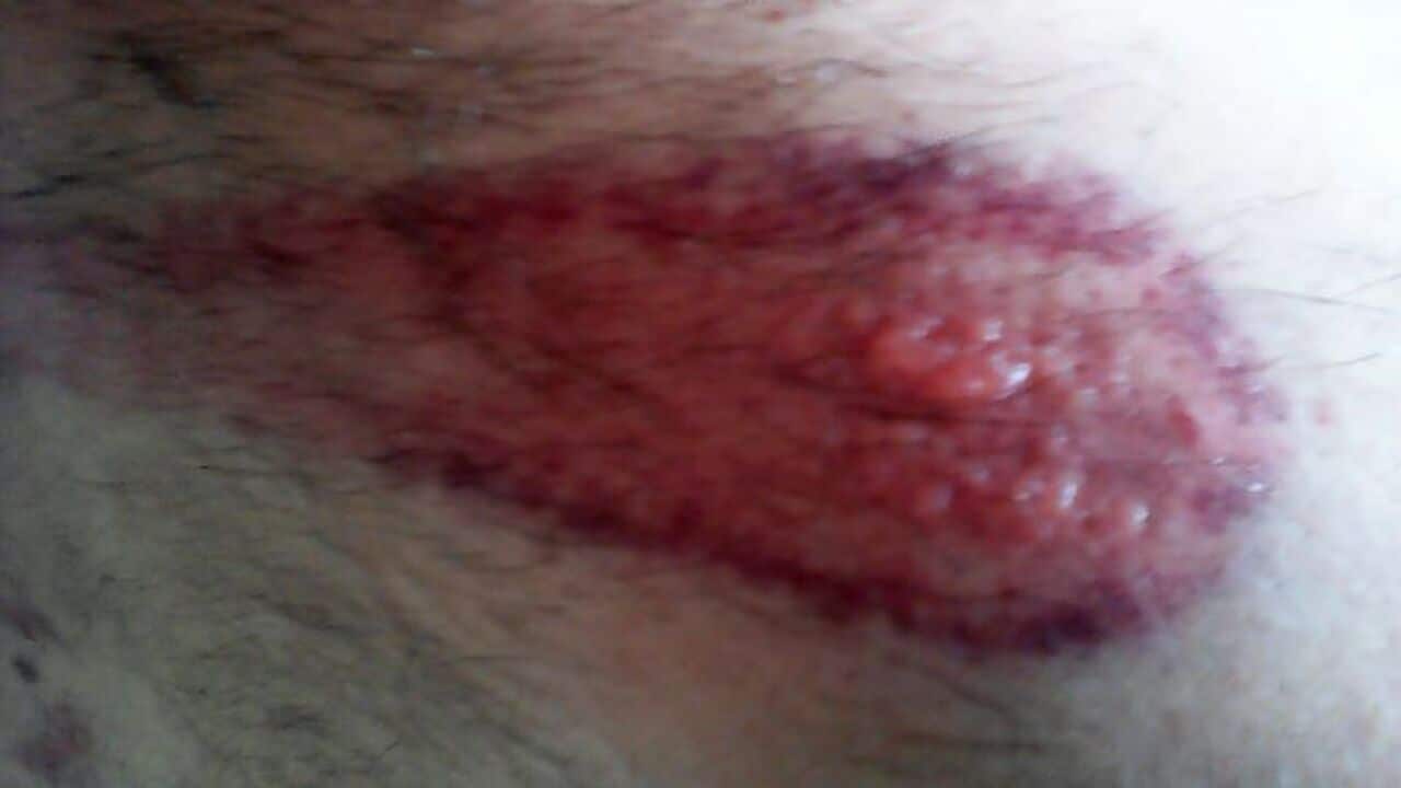 Image for read more article ''