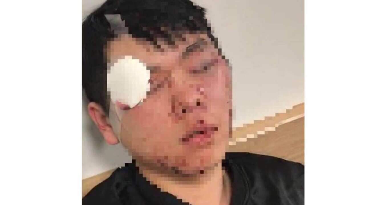 Chinese high school students allegedly bashed by youths at Canberra bus stop.