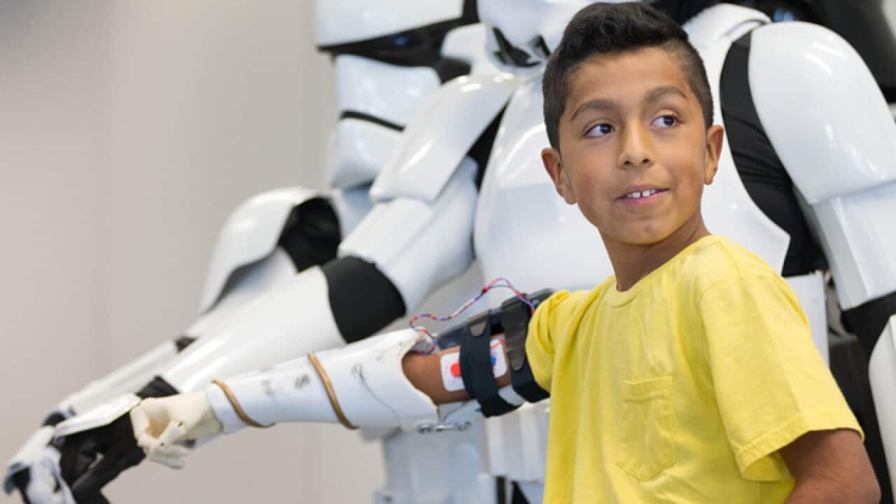 Alvin Garcia Flores with his prosthetic arm