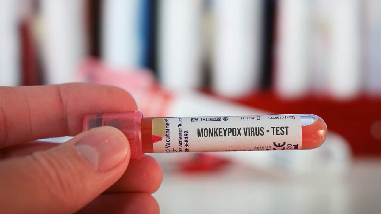 Test tubes labelled 'Monkeypox virus'.