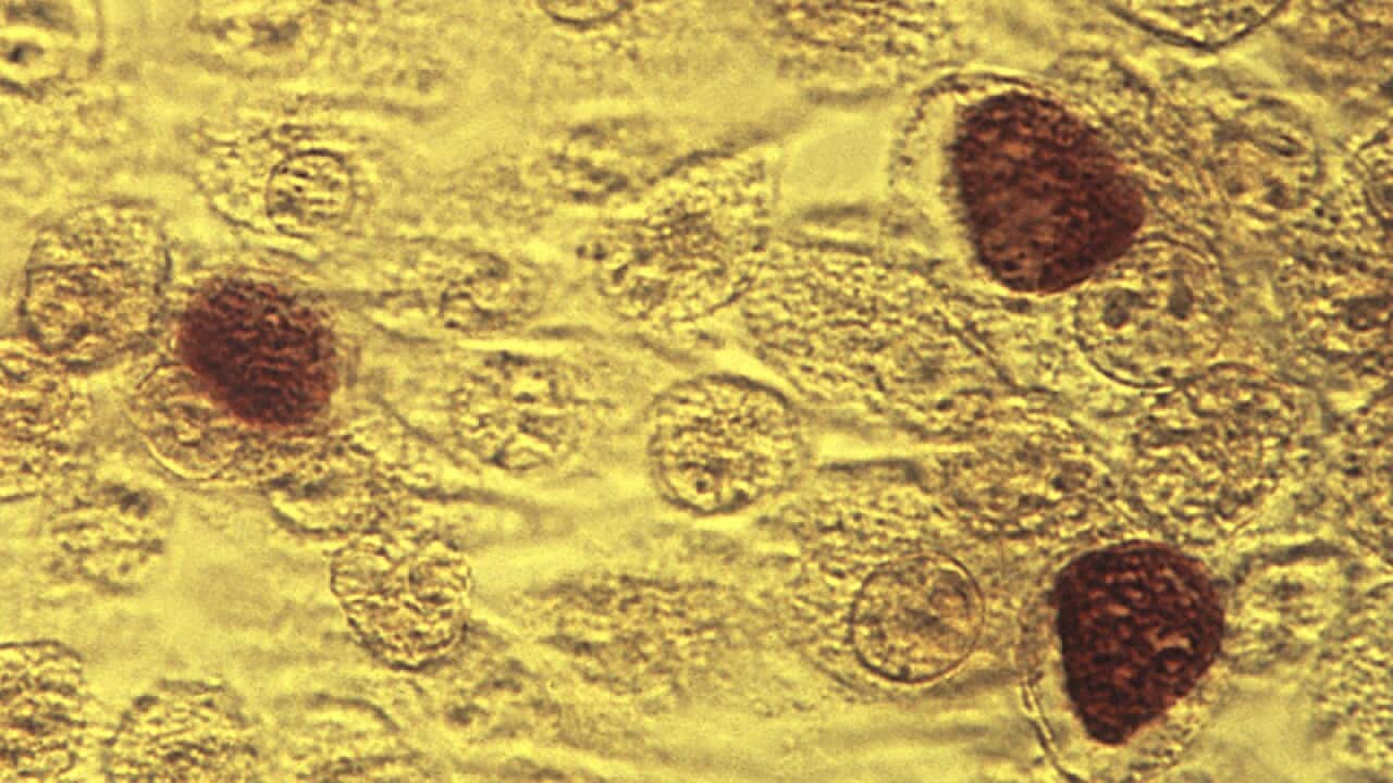Chlamydia trachomatis bacteria