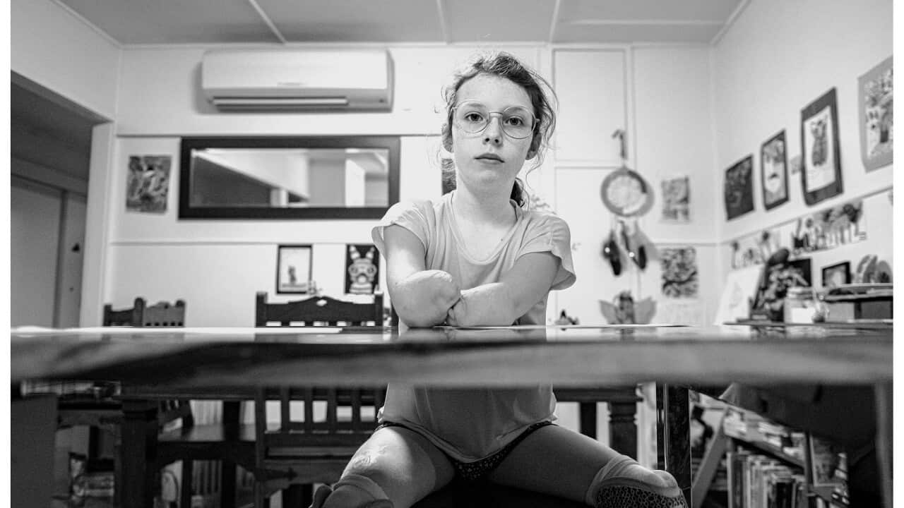 Mia (supplied Helene Cochaud).jpg