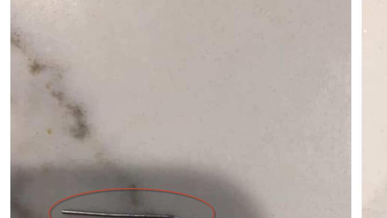 Melbourne woman finds metal object in ALDI grapes