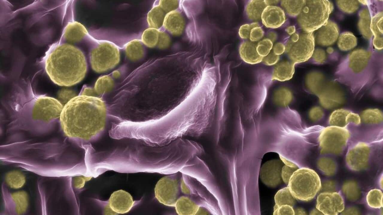 GOLD FUNGI FUSARIUM OXYSPORUM