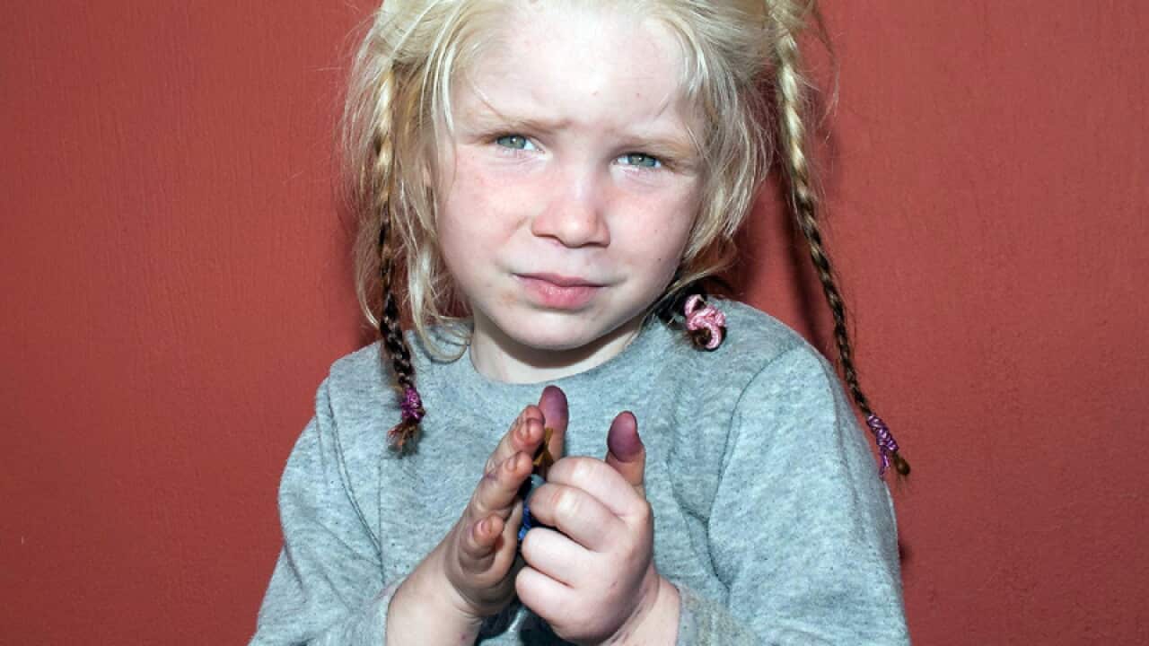 An unidentified 4-year-old blonde girl whom was found in Greece