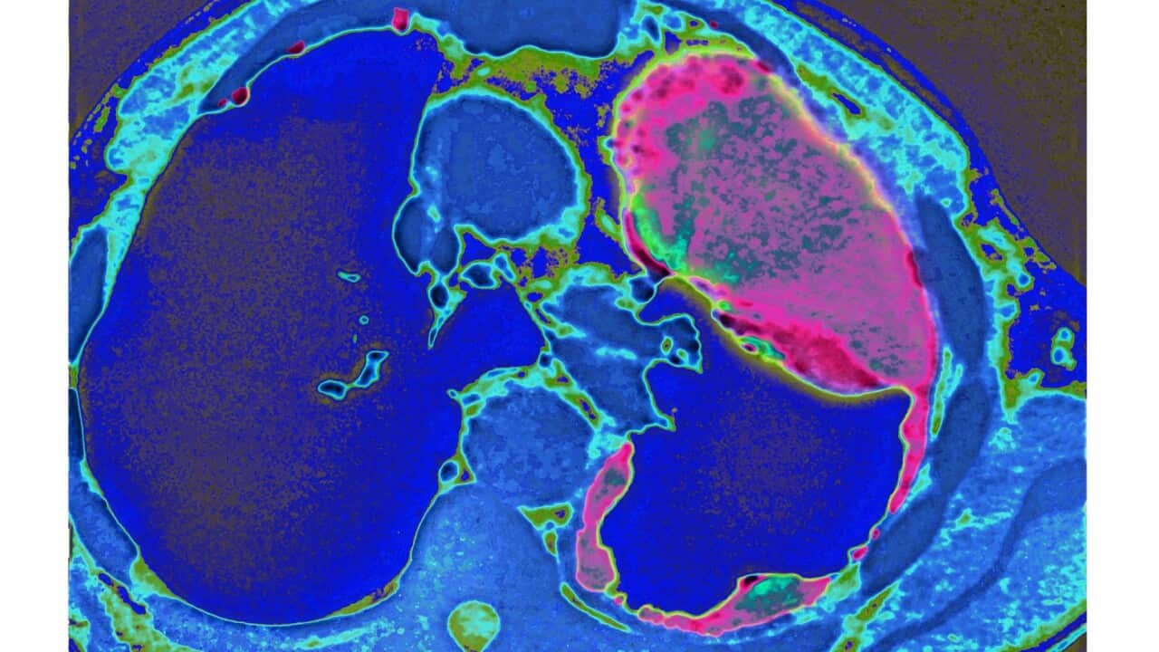 Image for read more article ''