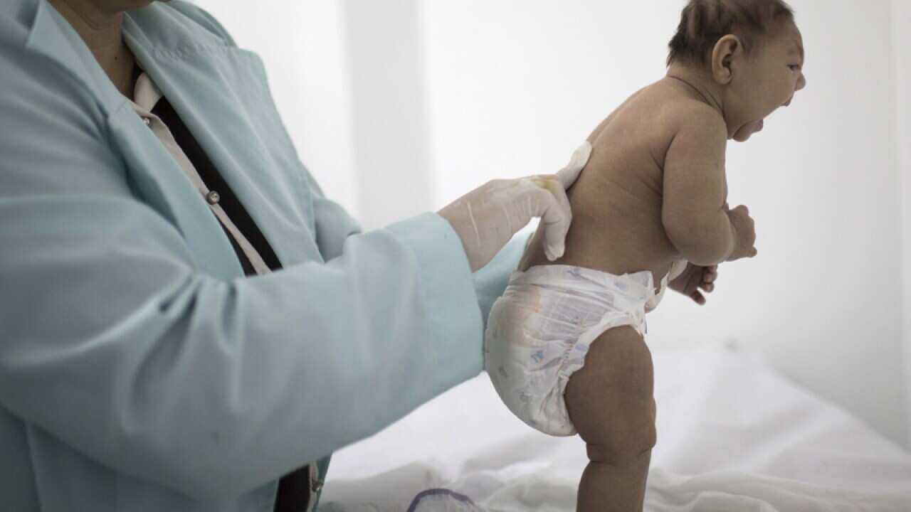 Lara, who is less then 3-months old and was born with microcephaly