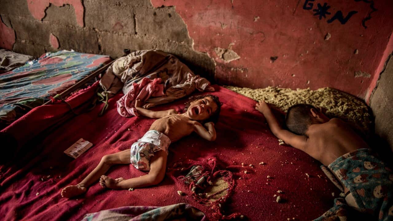 Anailin Nava, 2, was malnourished and suffering from an untreated condition. Her mother, Maibeli Nava, said doctors prescribe medications that are unavailable or unaffordable.