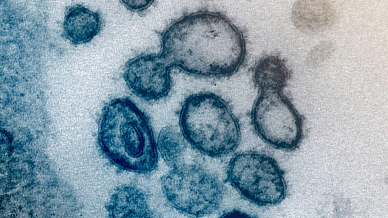 Electron microscope image from the US National Institutes of Health showing the Novel Coronavirus SARS-CoV-2, which causes COVID-19