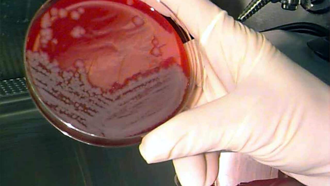 Live anthrax sent to Australia by US army