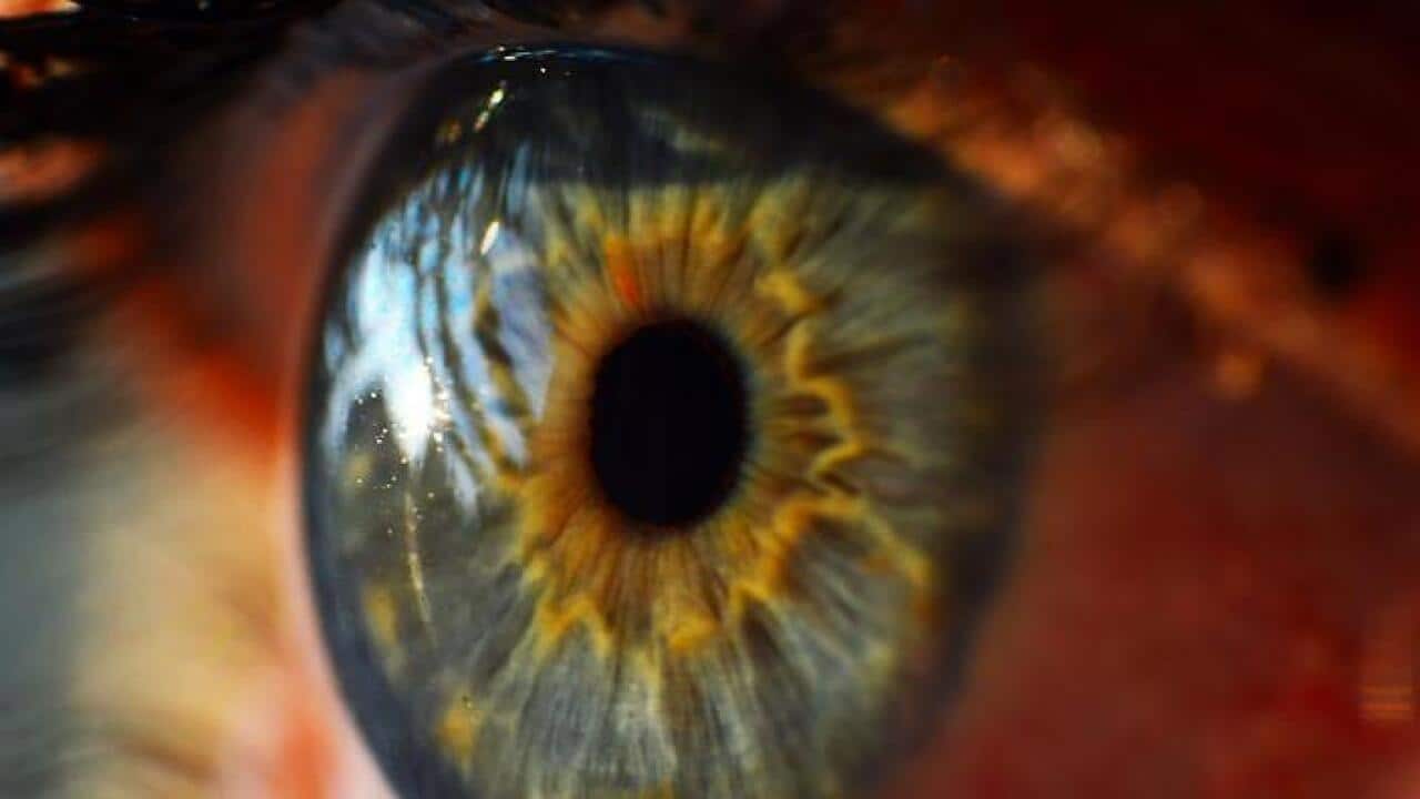 Eye surgery