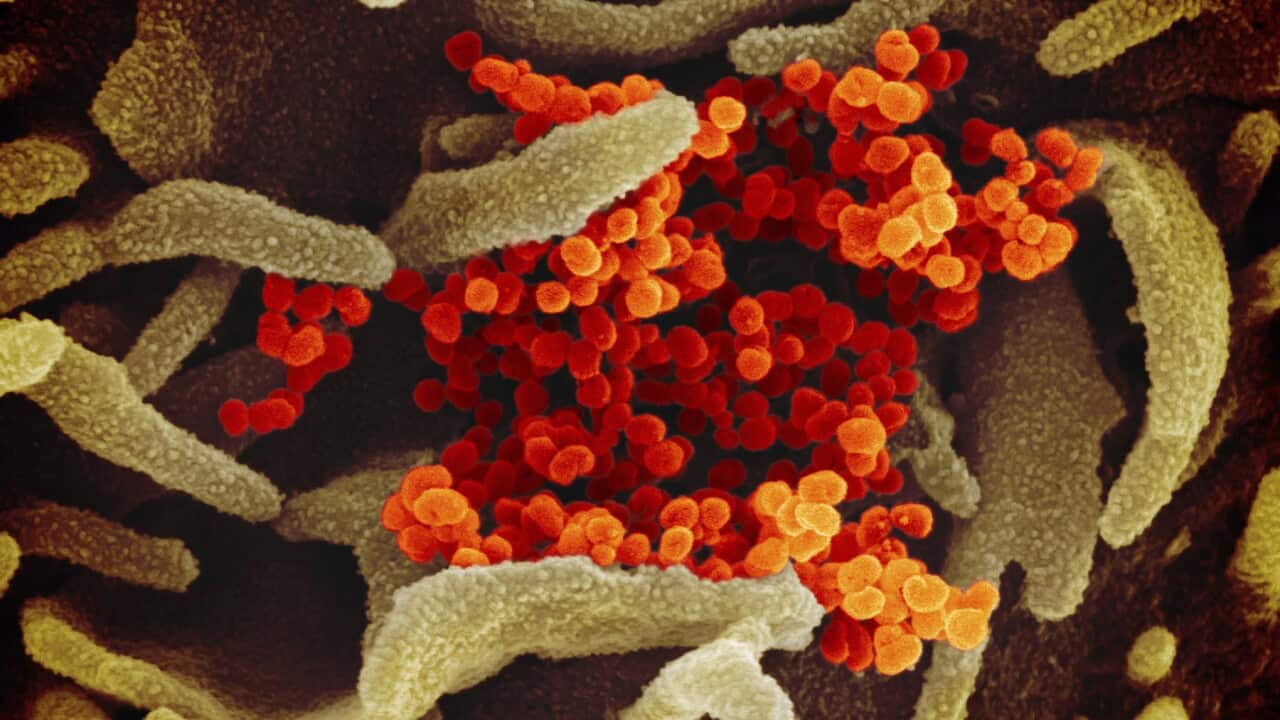 A microscope image of novel coronavirus
