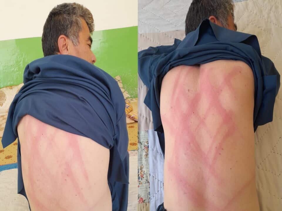 The photos were taken several days after Zahir’s release as he was threatened not to show them to anyone, Mr Norozi said.