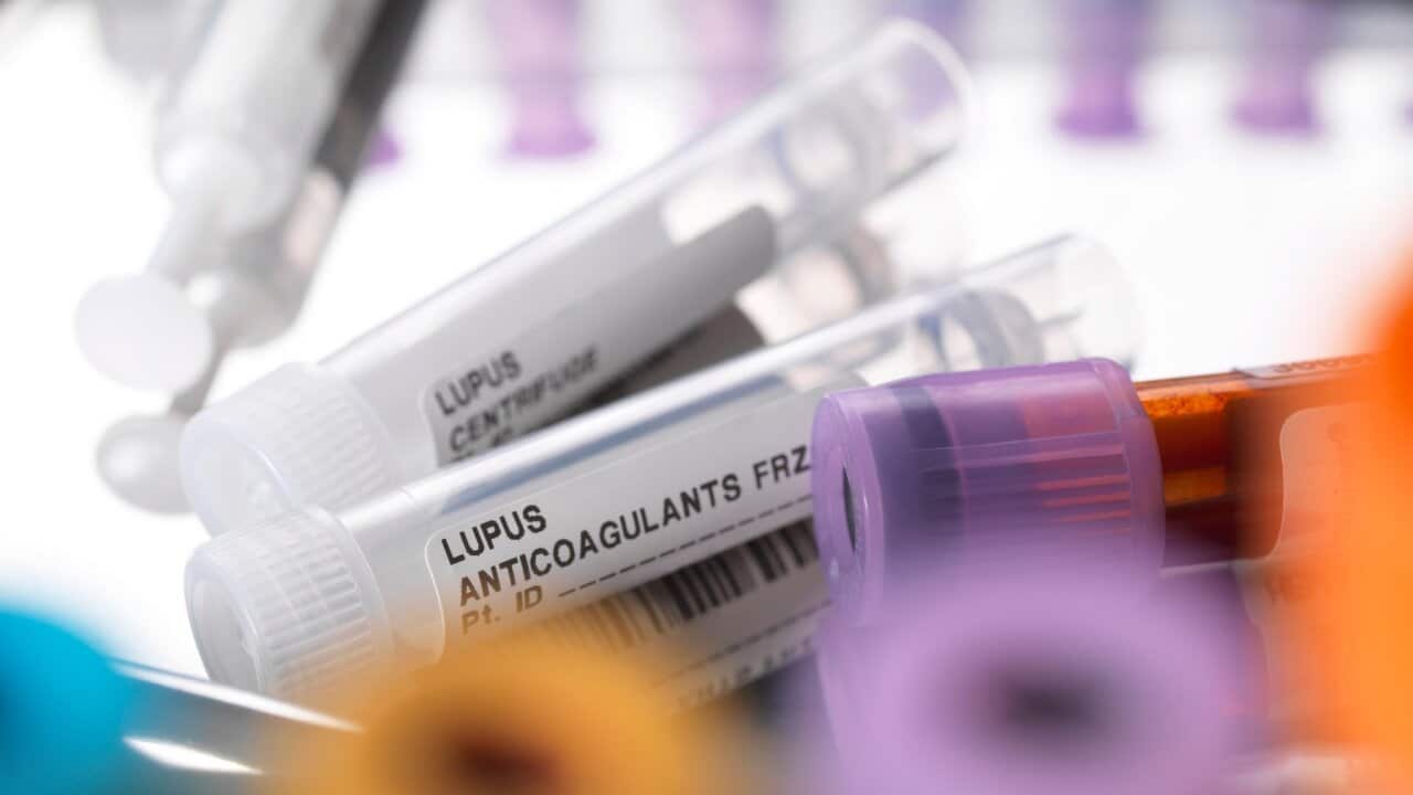 Lupus anticoagulants