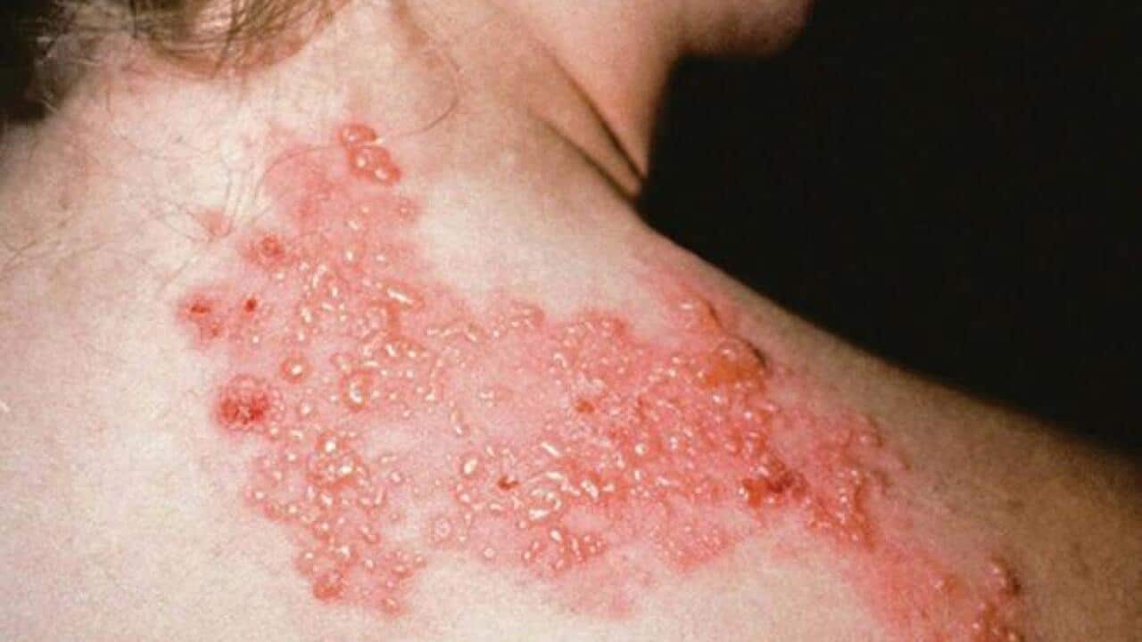 Image for read more article 'READ MORE'