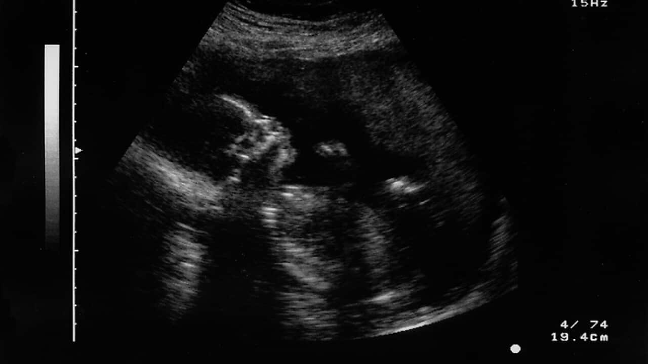 Ultrasound Illustration photo