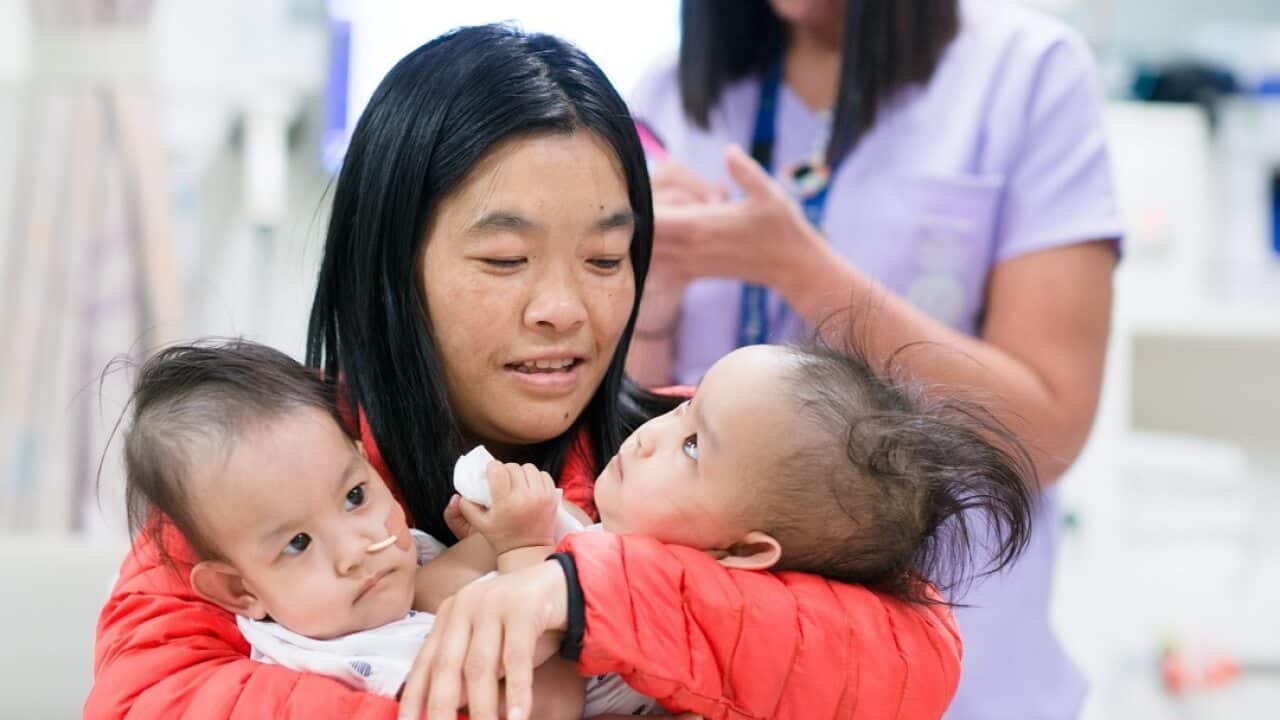The conjoined twins with their mother before going into surgery.
