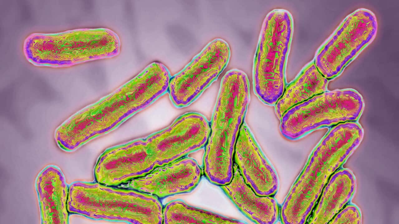 Salmonella bacteria responsible for salmonella. Seen under optical microscopy X 1000. (Photo by: BSIP/UIG via Getty Images)