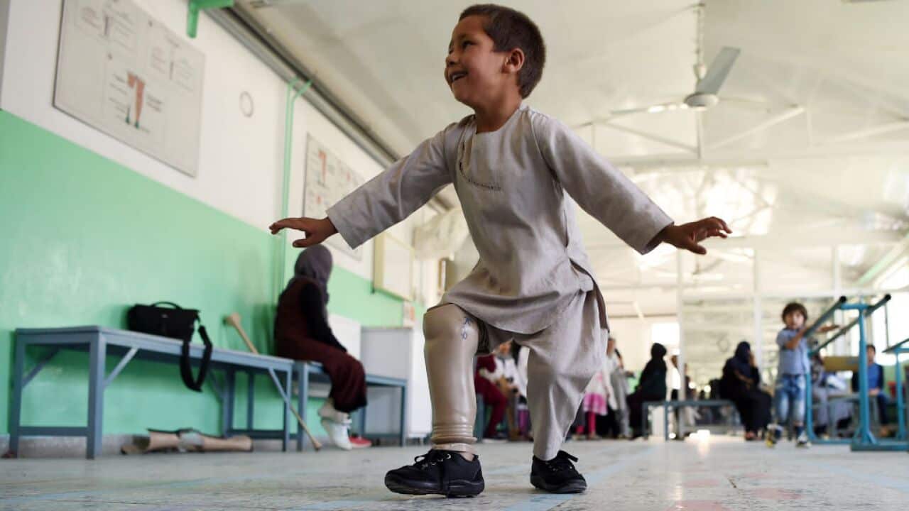 Ahmad Sayed Rahman dances at the International Committee of the Red Cross (ICRC) hospital for war victims and the disabled in Kabul.
