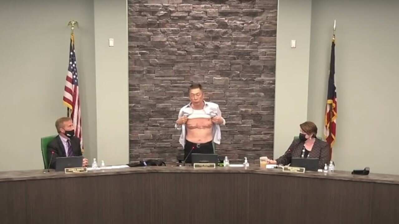 Board of Trustees Chairman Lee Wong shows his scars to a town hall meeting in Ohio, USA.