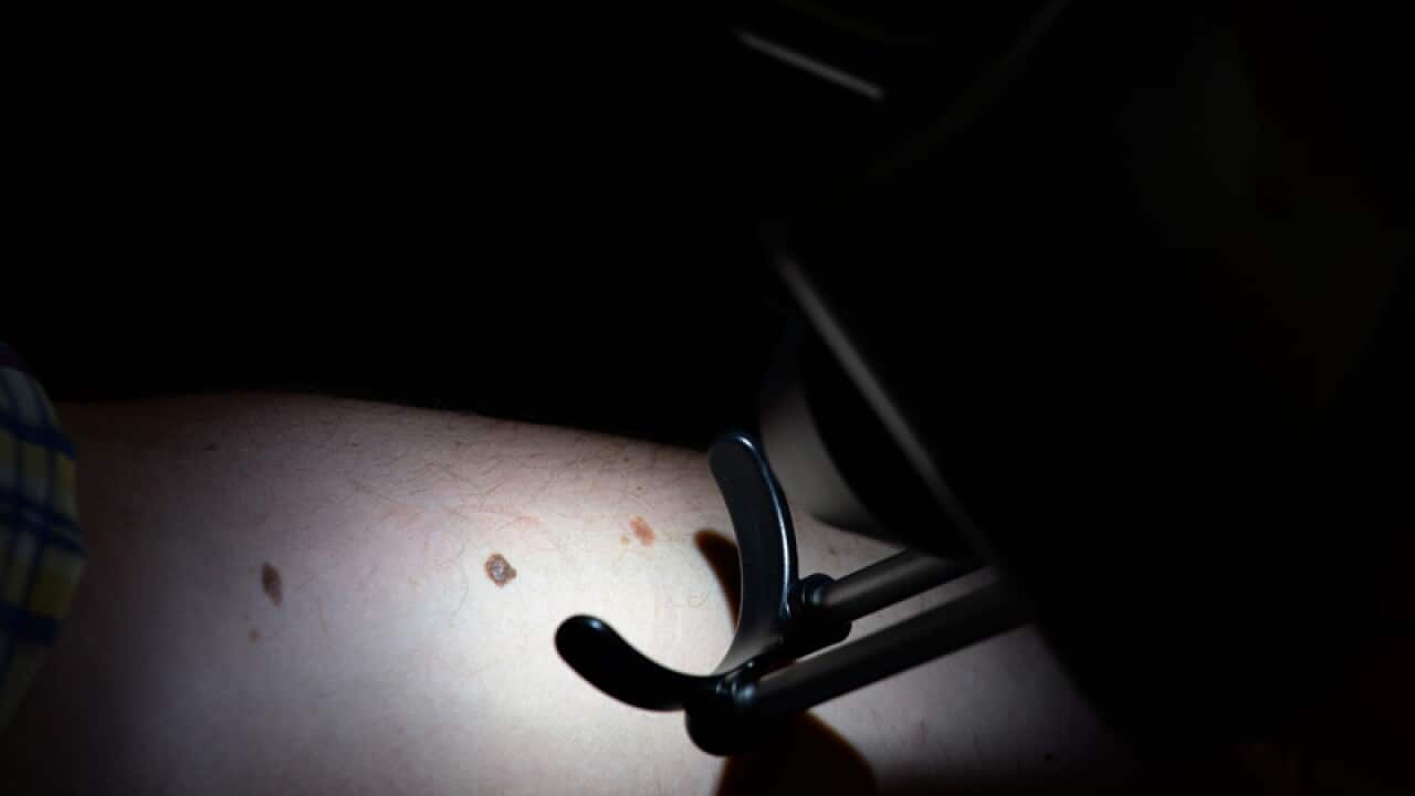 A patient is checked for skin cancers at a skin cancer clinic