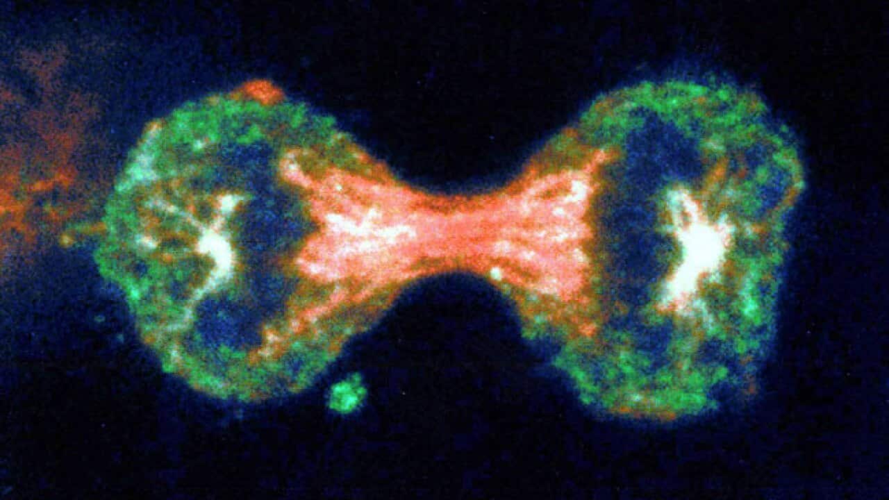 cancer-cell_100311_B_AAP_684866824