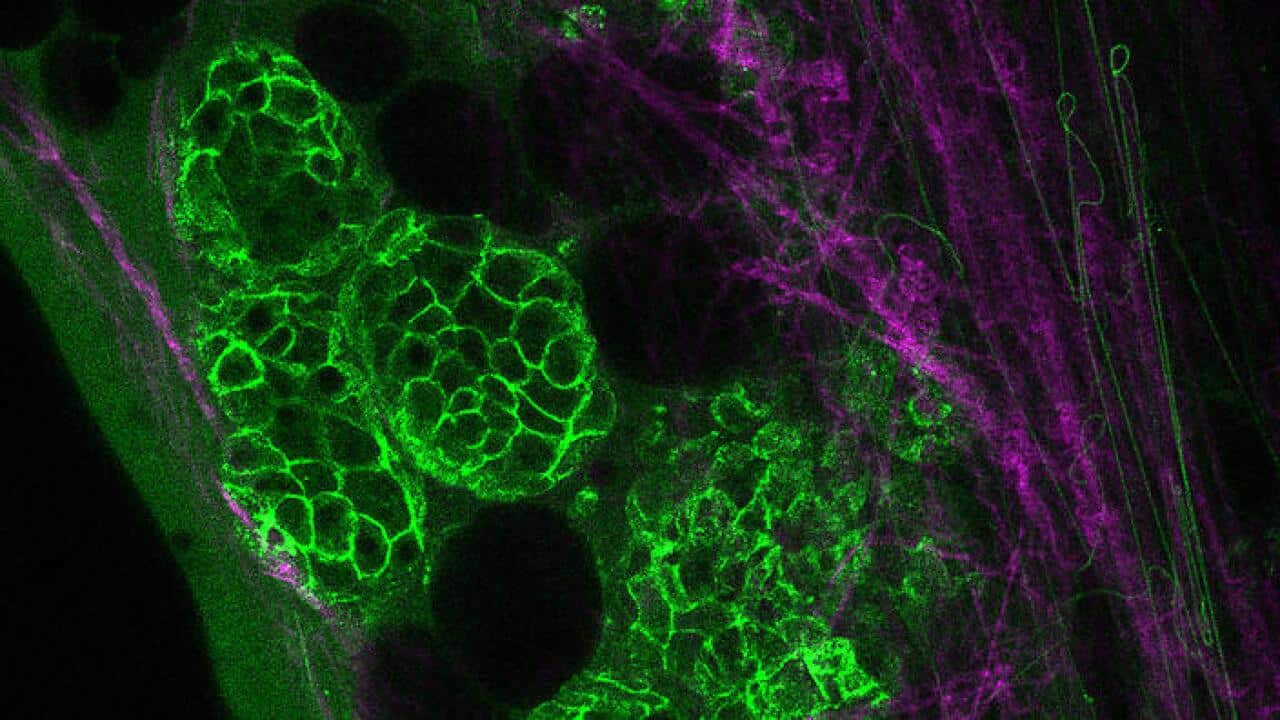 Cancer Cells Monitored