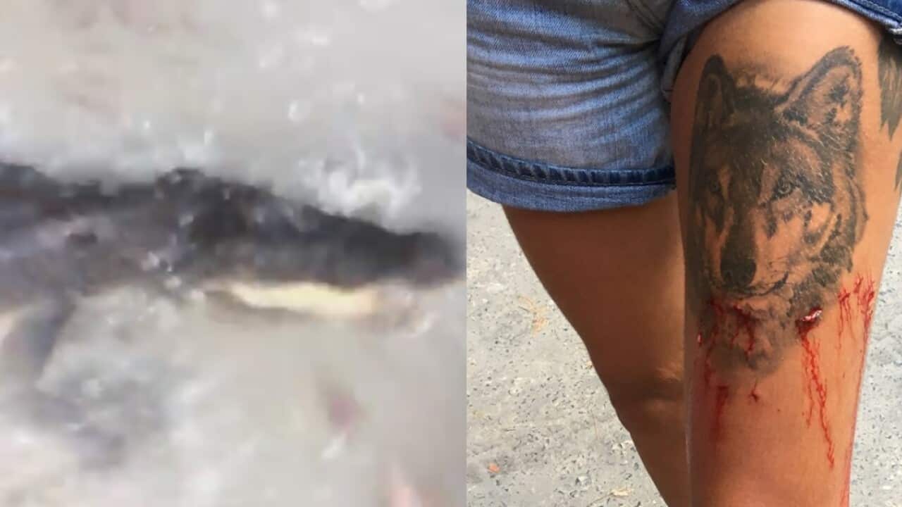 British tourist crocodile attack north Queensland