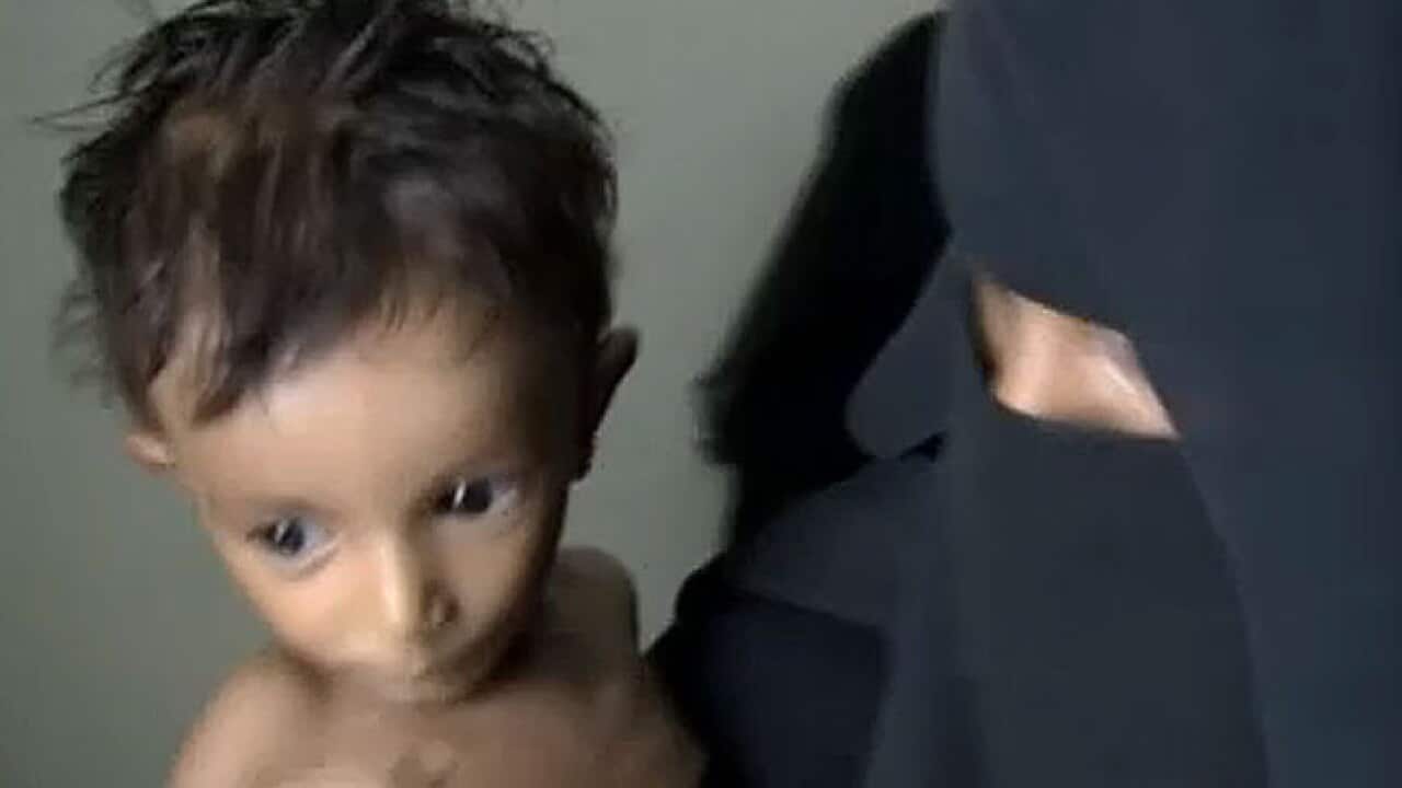 yemen_hunger_L_121002_ch4_1221934815