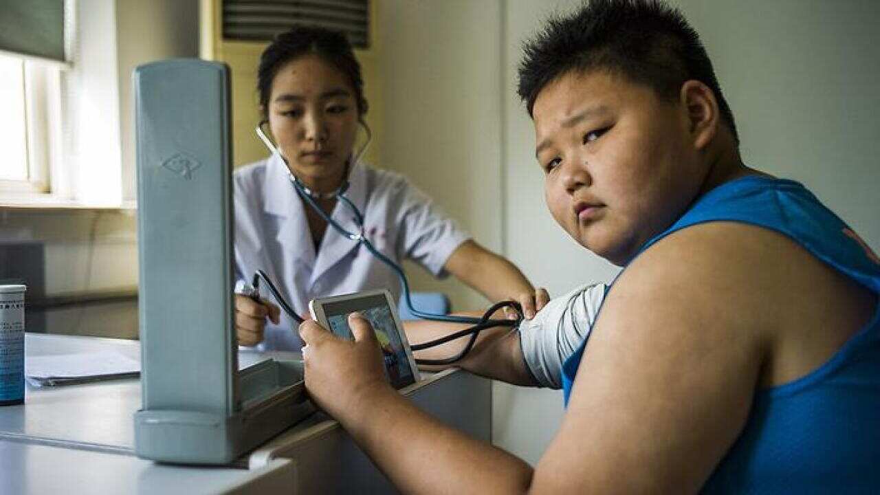 Child Obesity