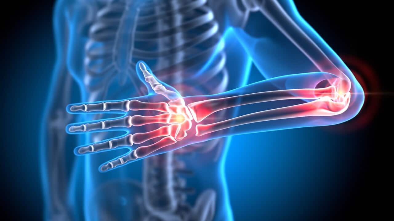 Painful Hand and Elbow Joints